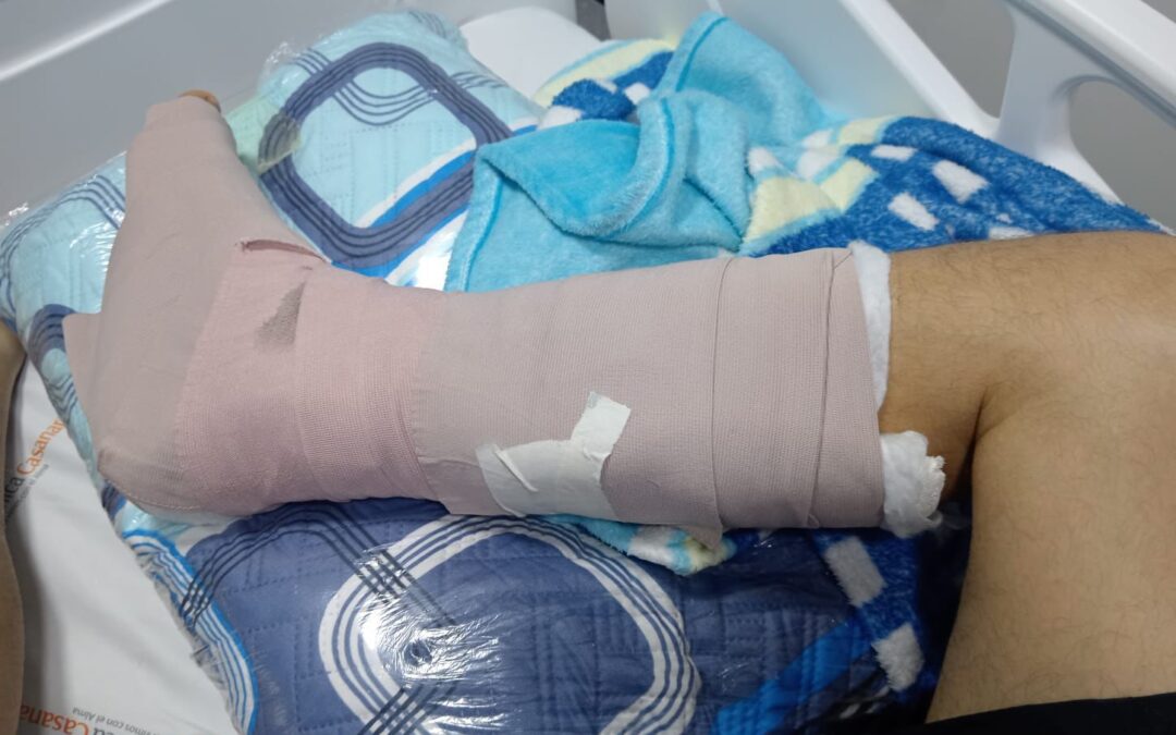 Casanareño lleva más de 35 días internado esperando un traslado para cirugía de reconstrucción de tejidos