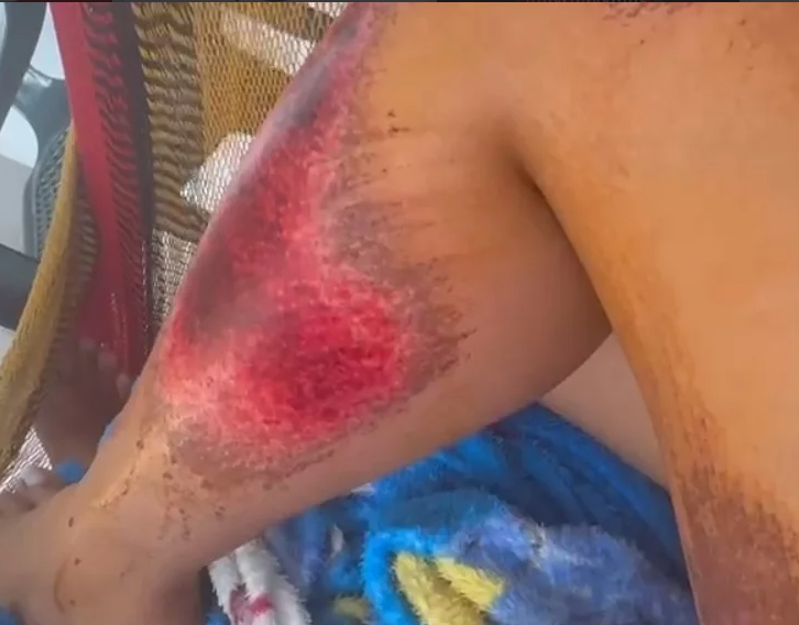 Delincuentes en moto causan lesiones a miembros de una familia en una vía rural de Yopal